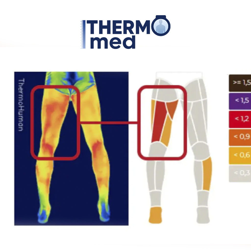 Análisis Térmico de Fatiga